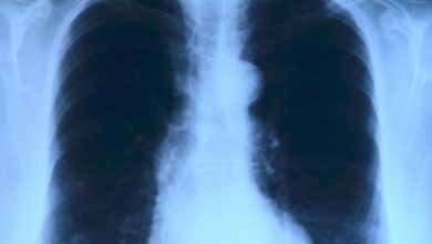 Photo of Антибиотики не спасают: как «убитый» туберкулез вновь обретает силу