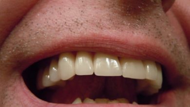 Photo of Почему желтеют зубы: неочевидные ошибки в питании и уходе