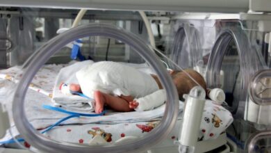 Photo of Смещение органов в грудную клетку: в Челябинске спасли новорожденную с редкой патологией