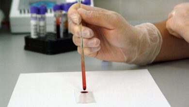 Photo of Одышка, ложкообразные ногти: как проявляется железодефицитная анемия